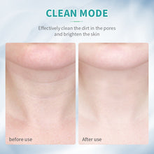 Charger l&#39;image dans la galerie, REJUVENECEDOR IMPORTADOR DE IONES DE LA PIEL LIFTING FACIAL PARA LÍNEAS DE CUELLO Y ARRUGAS ANLAN
